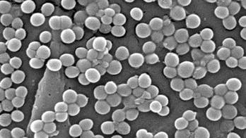 Superbug resistance follows seasonal drug use