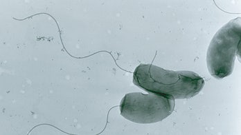 Yemen's suspected cholera cases soar to 1,410 within weeks: WHO