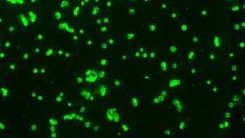 Doctors see increase of rabbit fever in humans