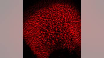 Scientists inject mice's ears with virus to help restore hearing