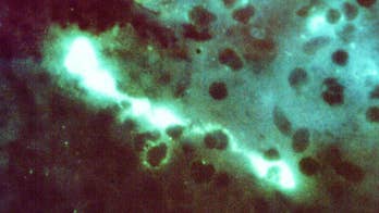 Researchers design nasal vaccine to protect against chlamydia