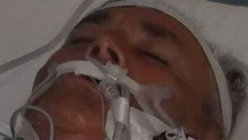 New Jersey dad who contracted flesh-eating bacteria while crabbing to be transferred to hospice, family says