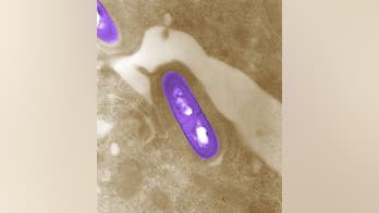 FDA wants food companies to hand over their pathogens