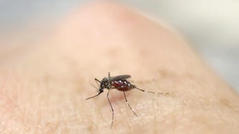 Scientists say Zika may be transmitted by oral sex, kissing