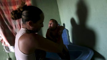 Study strengthens Zika-mirocephaly link, women and babies at risk