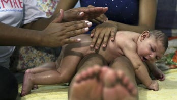 Brazil's confirmed, suspected microcephaly cases fall to 4,949