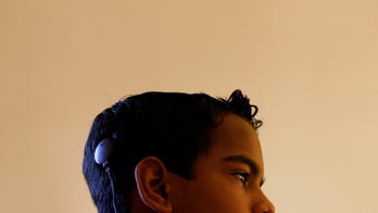 Depression symptoms may improve with cochlear implants