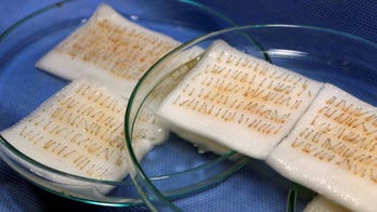 Hair transplants make men look more attractive, youthful: survey