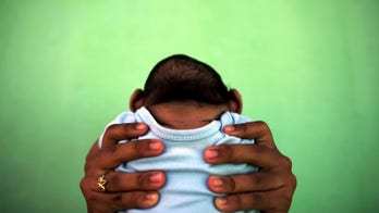 Zika virus can keep growing in infant brains even after birth, CDC reports