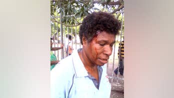 Official says police shoot students in Papua New Guinea