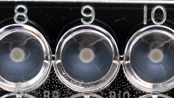 CDC to help Washington state find source of E. coli outbreak at milk fest