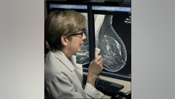 3D mammograms can better detect invasive cancers, reduce call-back rates