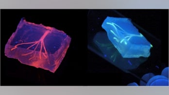 3D-printed blood vessels could be used for transplants