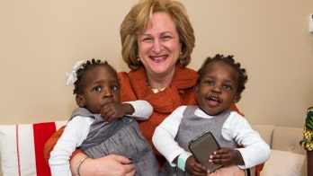 Once-conjoined twins thriving after separation surgery