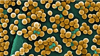 WHO: Drug resistant superbugs a serious threat worldwide