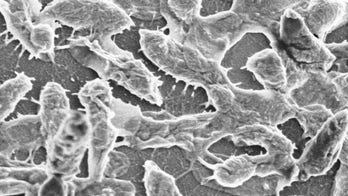 Florida man contracts flesh-eating bacteria through blisters while hiking