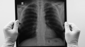 Simple breath test may help diagnose lung cancer, study finds