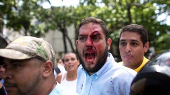 Venezuelan congressman injured in protest