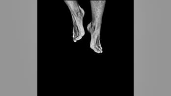 4 quick-fixes for common foot care complaints
