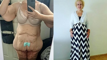 Woman who lost 252 pounds rejected on Tinder after sending pics of her excess skin