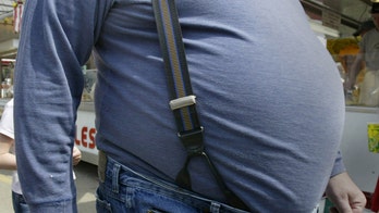 Extreme obesity cuts lifespan more than smoking, study says