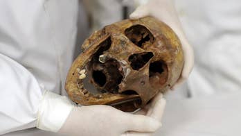 Bones of Mengele, 'Angel of Death,' teaching tool in Brazil
