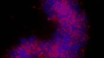 Scientists Create Glow Gel to Light Up Infections