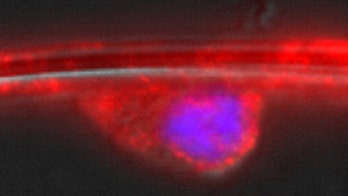Doctors trying to fix damaged nerves
