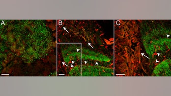 Zombie ants are scarier than you ever imagined