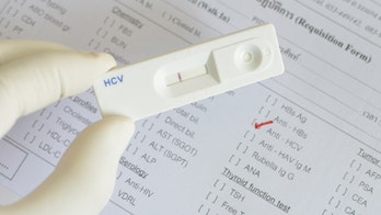 Hepatitis C could be 'rare disease' in 20 years, study says