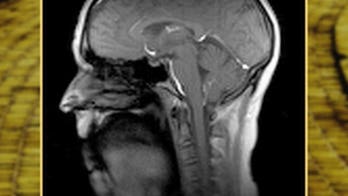 Dynamic MRI helps scientists study over 100 muscles involved in sound