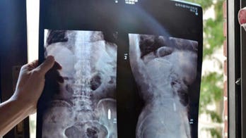 Vet’s stomach pains caused by hidden bullet lodged in stomach