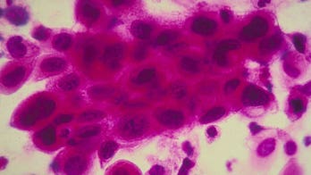 The real importance of getting a pap smear and pelvic exam