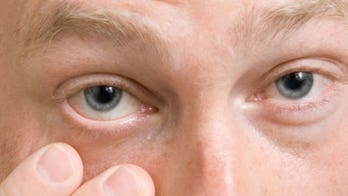 Chicago company offers eye exams via smartphone and computer for $40