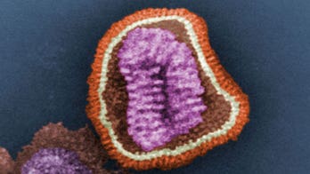 Health officials investigating after New Jersey man dies of Lassa fever following Liberia trip