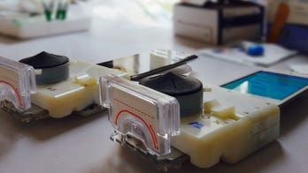 Scientists create smartphone accessory that detects syphilis, HIV in 15 minutes