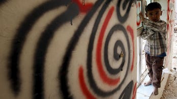 Half a million Yemen children face severe malnutrition, UN says