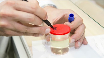 HPV urine test offers alternative method for cervical cancer screening