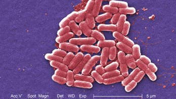 US investigates multi-state E.coli outbreak; no deaths reported