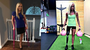 Woman enjoys 'new life' after leg amputation