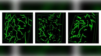 Young blood reverses aging in mice