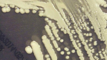 Anthrax outbreak in Russia kills child, sends dozens to hospital