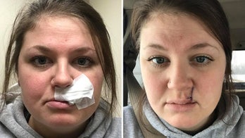 Woman slams tanning beds with skin cancer scar selfie