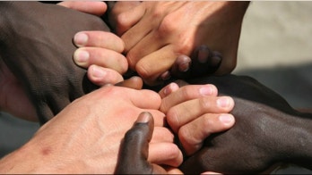 Odd cause of humans' dark skin proposed
