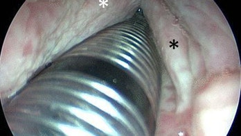 Man's throat began to rot after he mistakenly swallowed bleach tablet