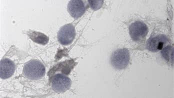 Boys conceived via fertility treatment may inherit father's poor sperm