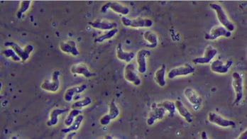 Rare brain-eating amoeba infection confirmed in Florida, health officials say