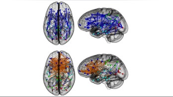 How men's brains are wired differently than women's