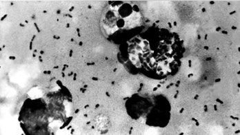Hidden plague? New theory on how disease spread so perilously