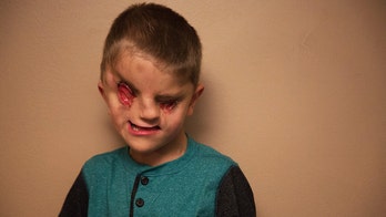 'I was born awesome': 6-year-old born with no eyes is raising awareness about being different